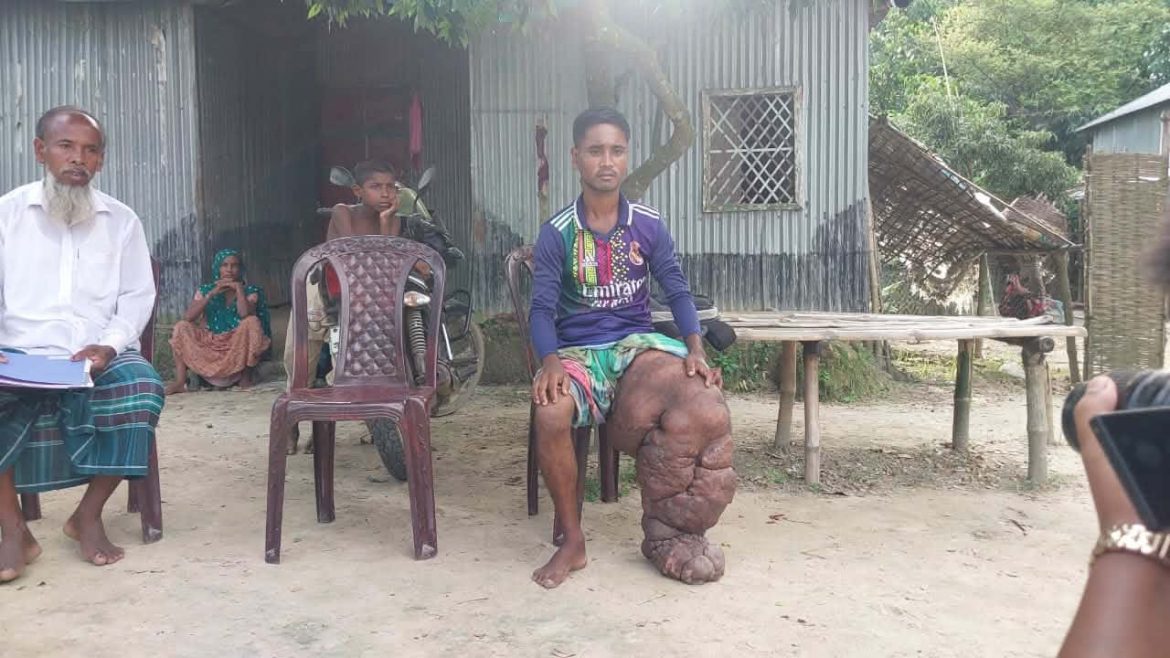 বিরল রোগে অসহায় আবু বক্কর, ব্যয়বহুল চিকিৎসায় হাত বাড়ানোর আহ্বান